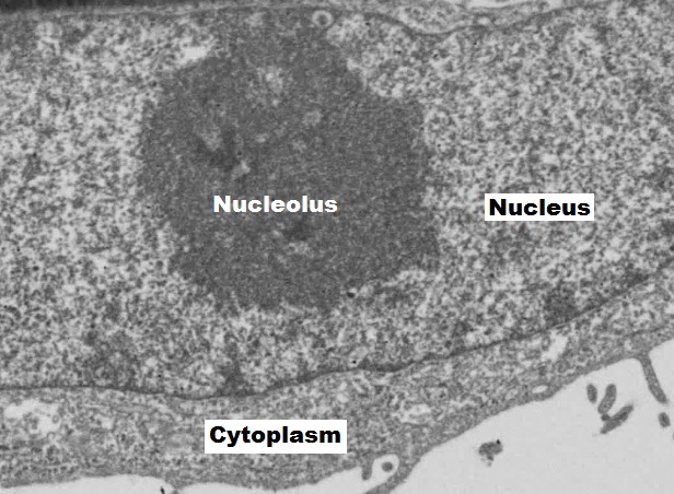 HeLa 세포의 전자현미경 정지 사진. 원파일에 핵소체 Nucleolus, 핵 Nucleus, 세포질 Cytoplasm 표기가 있다.