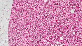신경 가로 절편의 현미경 사진. 분홍빛 바탕에 크고 작은 둥근 단면이 빽빽이 모여 있고 여러 단면의 가운데에 작은 점이 보인다.